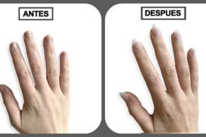 como hacer crecer las uñas rapido