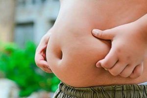 causas de la obesidad infantil