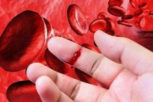 Tratamientos para la hemofilia