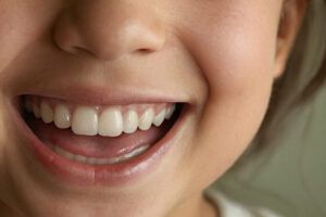 una niña sonriendo y mostrando sus dientes sanos